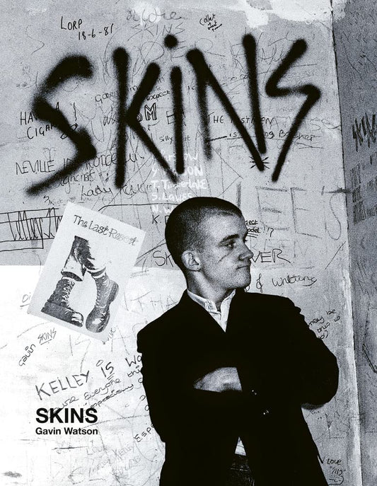 SKINS