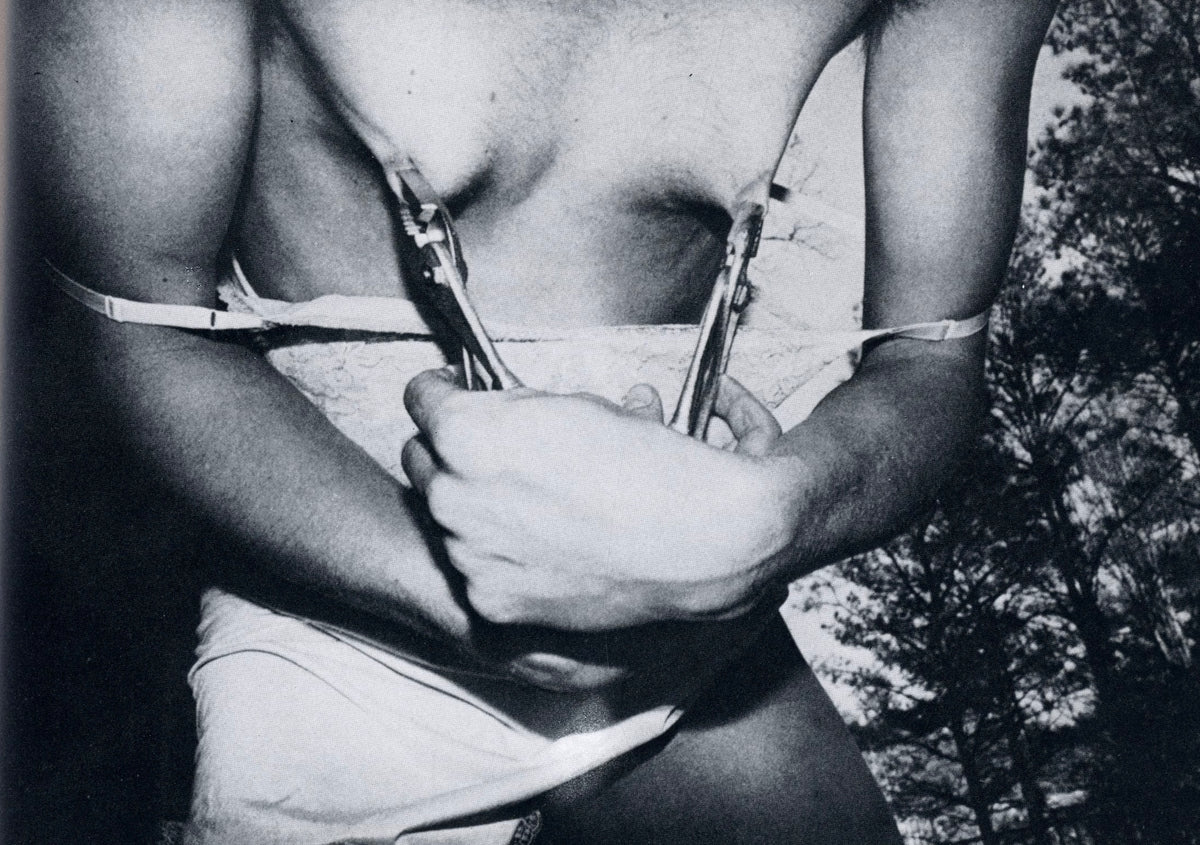 Photograph from Submission: close-up of a torso with clothespins clipped to a white undershirt, hands at the chest.