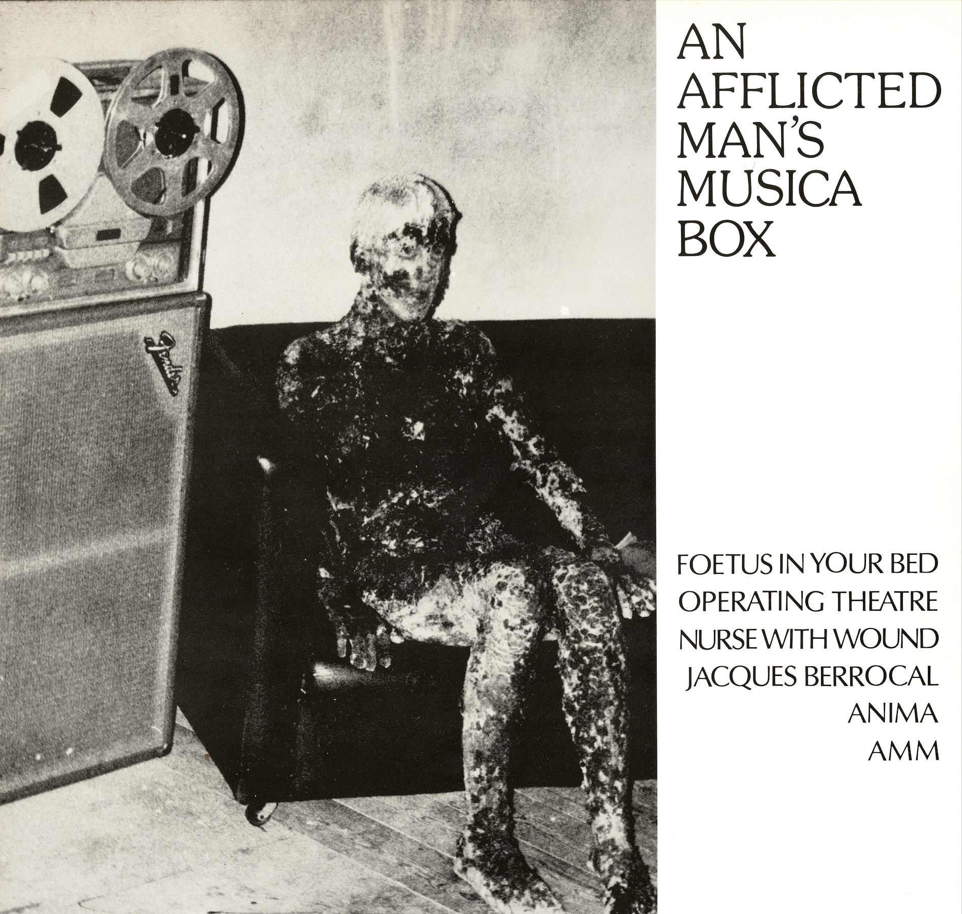 Front cover of the 1985 United Dairies LP second version with the Burned Man photograph.