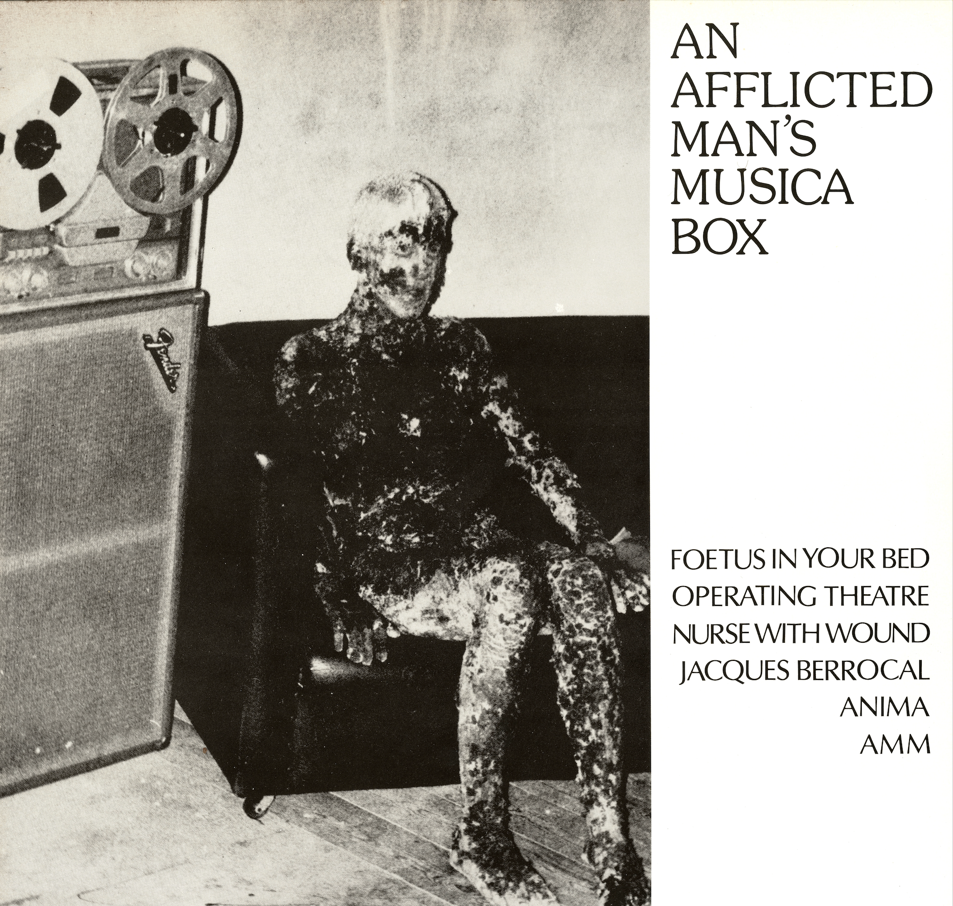Front cover of the 1985 United Dairies LP second version with the Burned Man photograph.
